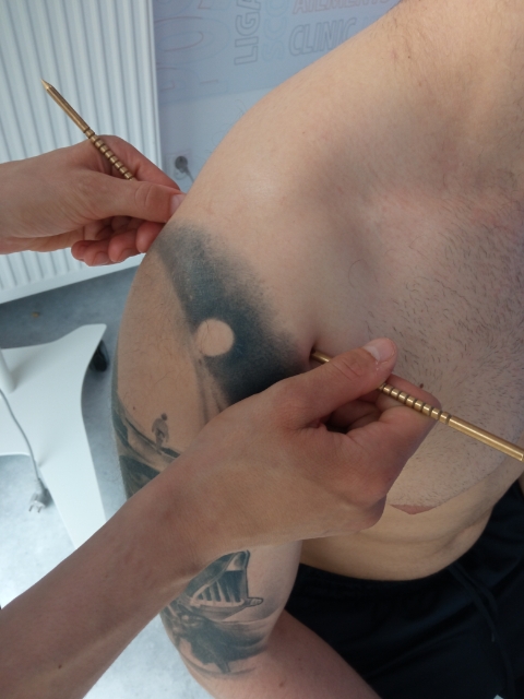 Co to jest Pinoterapia?